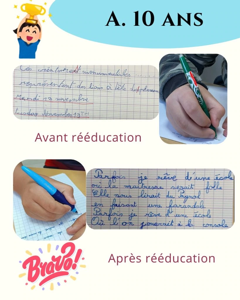 avant apres a 1 1080x1350