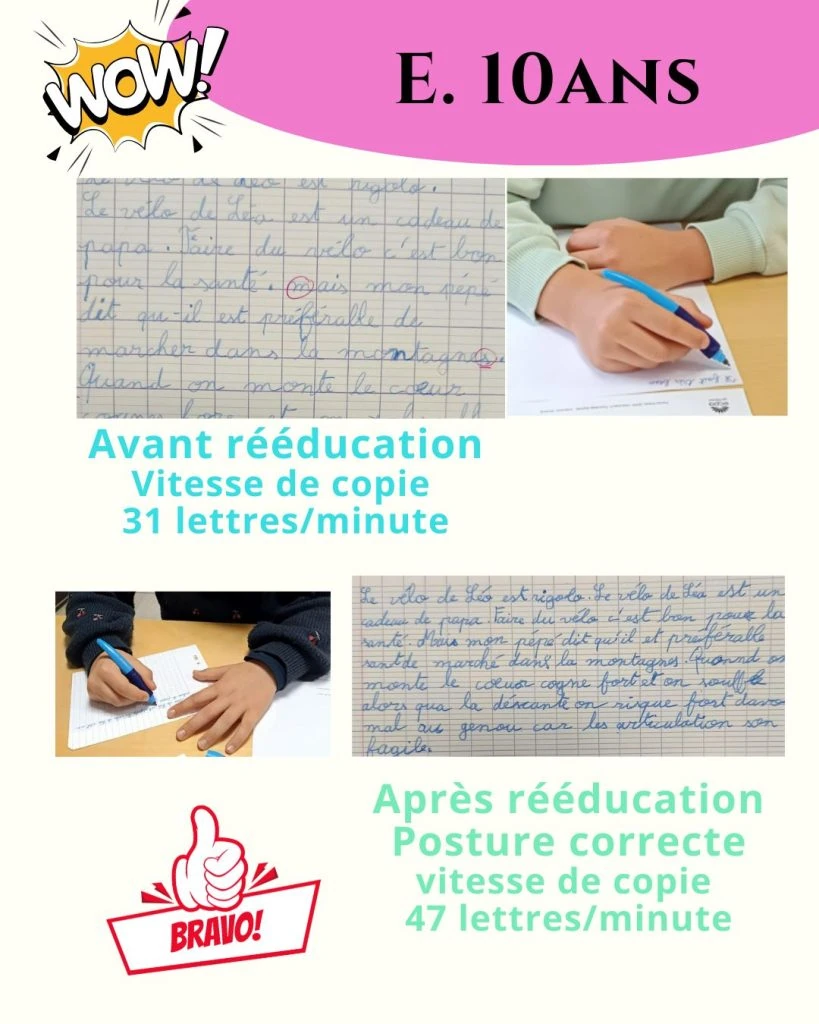 avant apres en 1 1080x1350