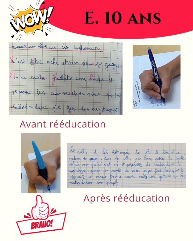avant apres et 1 1080x1350