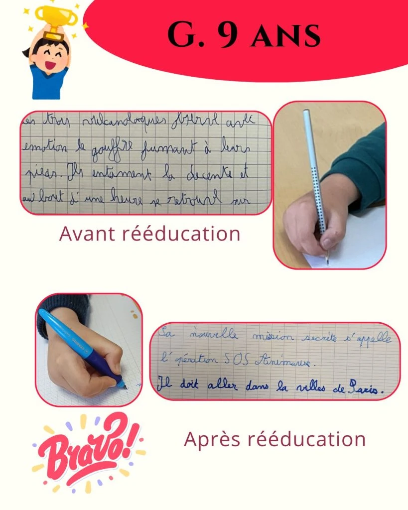 avant apres g 1 1080x1350