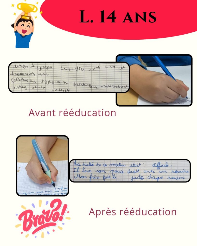avant apres lu 1 1080x1350