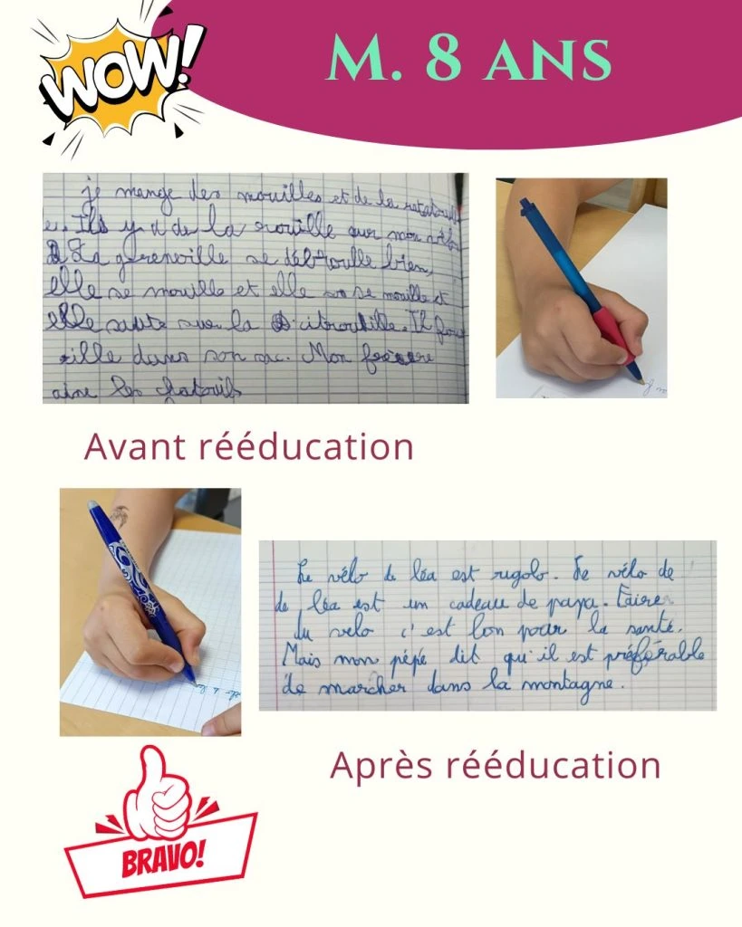 avant apres ma 1 1080x1350