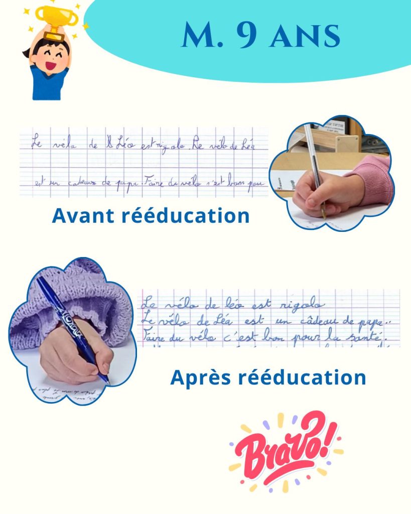 avant apres mo 1 1080x1350